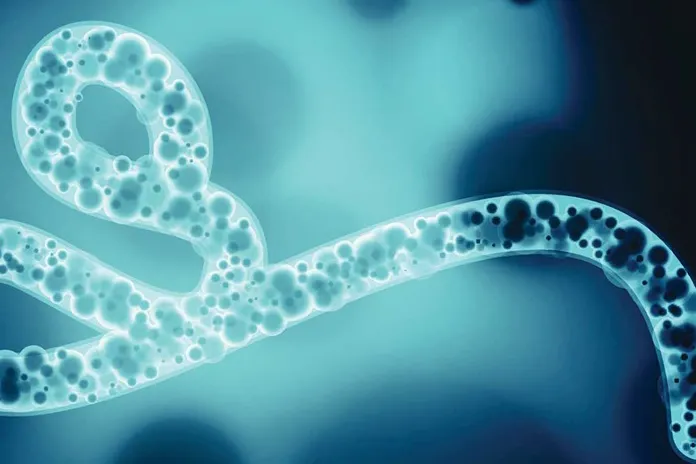Ebola